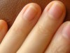 爪の伸び方は、指ごとに違うのをご存知でしょうか？爪で健康状態も分かってしまうのです